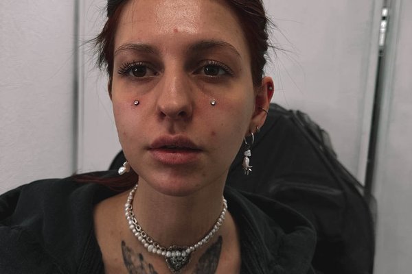 dermal piercing