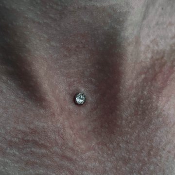 dermal piercing