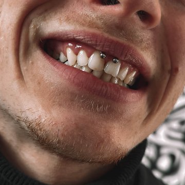 smile'i augustamine