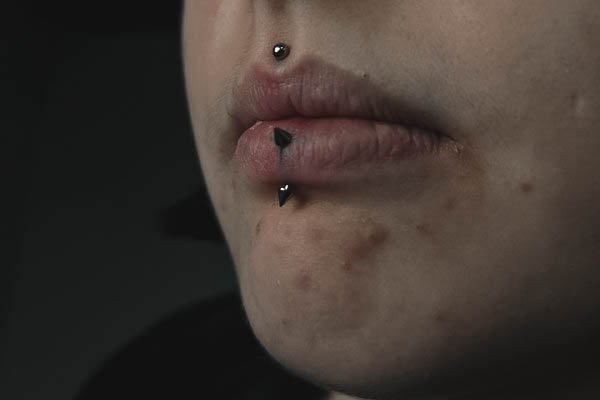 Medusa piercing