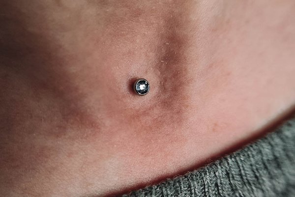 dermal piercing