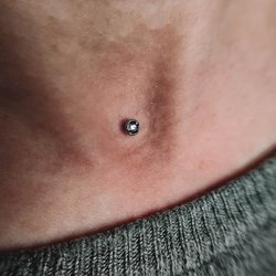 Dermal