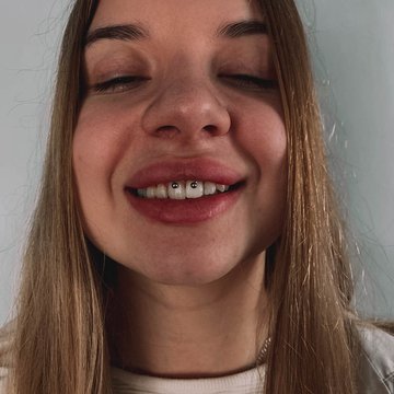 smile'i augustamine