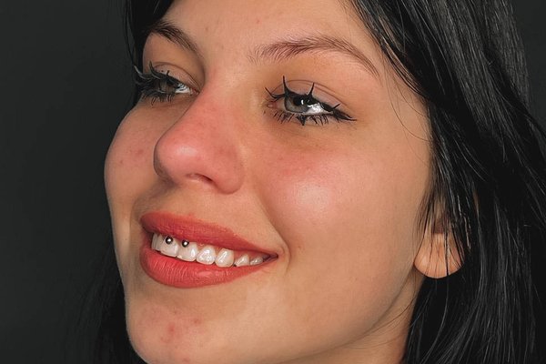 smile'i augustamine