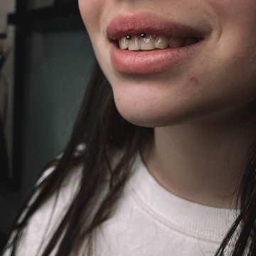 smile'i augustamine