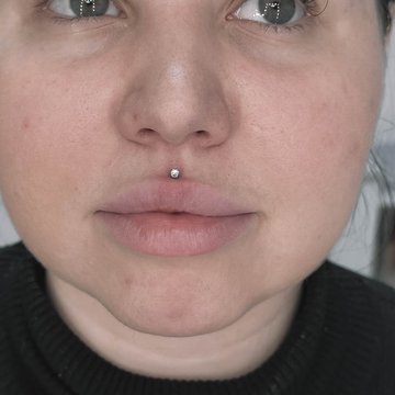 Medusa piercing