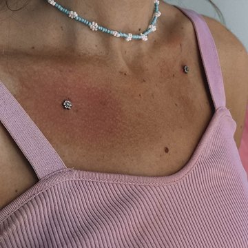 dermal piercing
