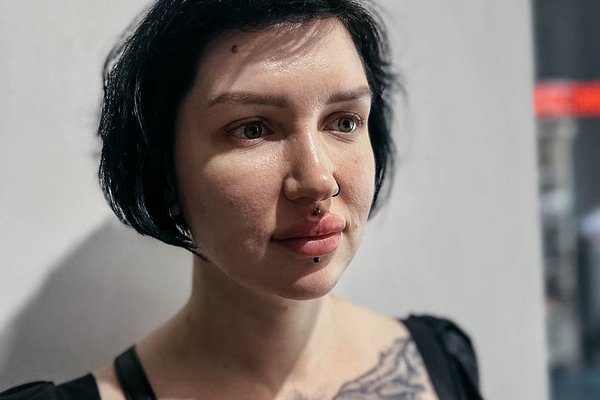 Medusa piercing