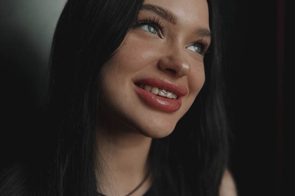 smile'i augustamine