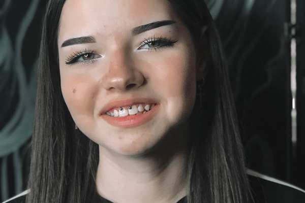 smile'i augustamine