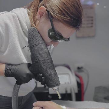 tattoo laser lightening course in Tallinn