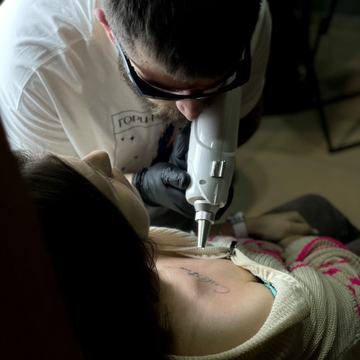 tätoveeringu laservalgendamine Tallinnas