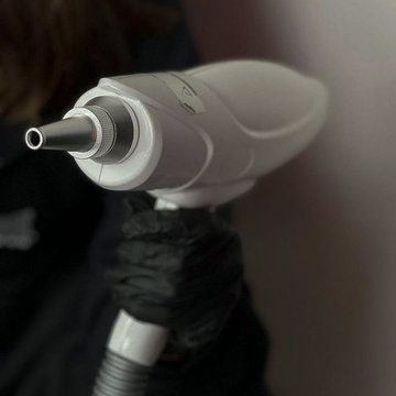 Permanentselt meigi eemaldamine laseriga Tallinnas